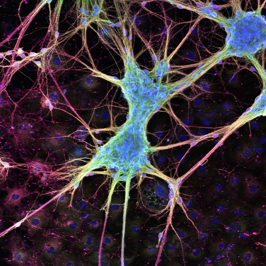 Microscopy-style supplied image of nerve cells, used only as a scientific illustration